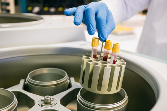 Crop person in latex gloves putting tubes with blood samples into analyzer while working in laboratory