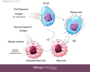 Mechanism of Human allergic reaction caused by a foreign substance or Allergens like pollen grain which are harmless but lead to hypersensitivity and activation of Mast cell degranulation vector eps - obrazy, fototapety, plakaty
