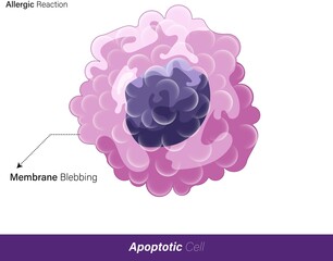 vector of Structure of cell undergoing Apoptosis showing the details of the membrane blebbing  and pinching of membrane vesicles 