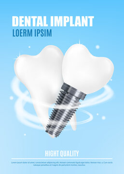 Vector medical poster with realistic illustration dental implant and human tooth