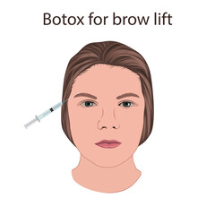 Botox for brow lift. Young woman face with syringe. Vector illustration.