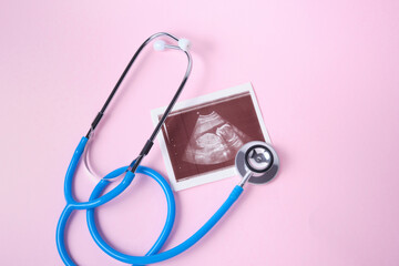 a medical stethoscope and embryo picture on pink background