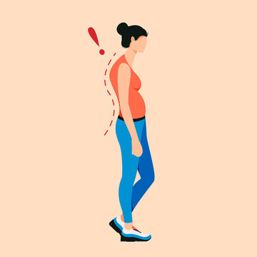 recommend clip art: Osteoporosis flat cartoon illustration. Curve posture, back pain, spine injury. Rachiocampsis.