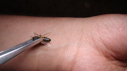 bee : apis mellifera treatment by honey bee sting closeup honey bee stinging a hand close up bee worker insects, insect, animal, wildlife, wild nature, forest, woods, garden beauty of pollination