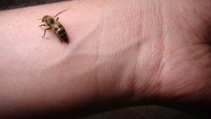 bee : apis mellifera treatment by honey bee sting closeup honey bee stinging a hand close up bee worker insects, insect, animal, wildlife, wild nature, forest, woods, garden beauty of pollination