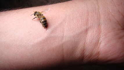 Obraz premium bee : apis mellifera treatment by honey bee sting closeup honey bee stinging a hand close up bee worker insects, insect, animal, wildlife, wild nature, forest, woods, garden beauty of pollination
