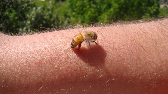 bee : apis mellifera treatment by honey bee sting closeup honey bee stinging a hand close up bee worker insects, insect, animal, wildlife, wild nature, forest, woods, garden beauty of pollination