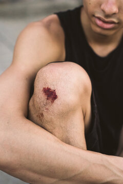 Knee wound