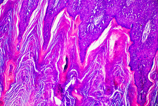 ill human skin