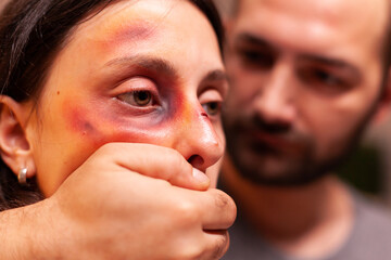 Close upf woman with bruises because of agressive husband. Violent aggressive husband abusing...