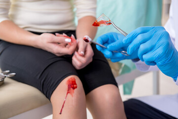 Obraz na płótnie Canvas Leg injured woman visiting male doctor