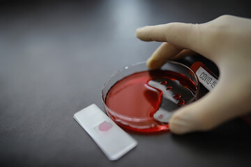 Test tube with patient blood for testing. Analysis for the virus. Coronavirus pandemic laboratory...