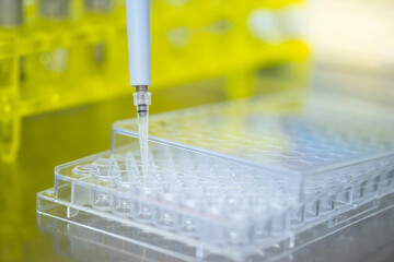 Close up macro of micropipette transfer sample into an Eppendorf under sunlight with blurred background. Eppendorf put on the yellow rack. Biosafety pharmaceutical and coronavirus concept.