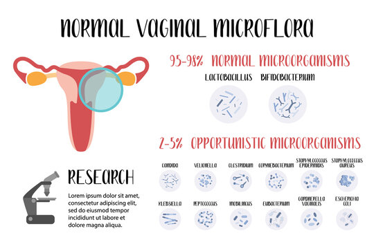 Normal vaginal microflora, lactobacillus, bifidobacterium. Normal and opportunistic pathogenic microorganisms. Female reproductive system. Gynecology. Vector flat cartoon illustration