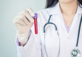 skilful doctor in gown and stethoscope holding blood tube of patient at hospital or clinic. lap worker or professional concept.
