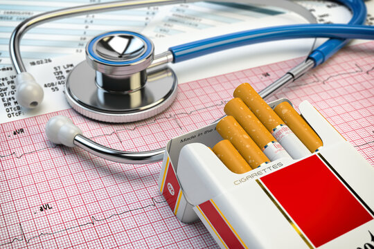 Stop smoking concept. Stethoscope, pack of cigarettes and electrocardiogram report. Examination of heart.