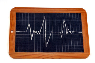 Graphique dessiné sur une ardoise d'école