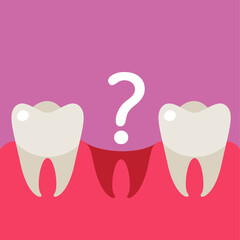 Tooth extraction, denture flat cartoon illustration. Wisdom tooth removal medical banner. Dentistry, orthodontist design background.