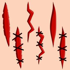 Bloody wound. Set of scratches. Stitches and medical care. Template for skin injury. A Bleeding Cut. Flat cartoon illustration