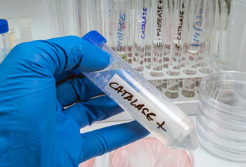 ntist holds vial with catalase enzyme that helps regulate  cytokine production, protects oxidative...