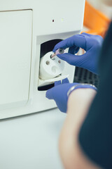 Analyzing the blood condition in modern equipment