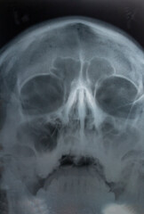 x-ray human face head