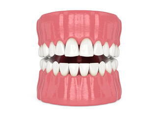 3d render of human jaw with black triangles