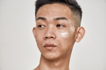 Close up portrait of young asian man with problematic skin applied cream on his face, looking aside...