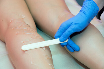 Laser hair removal procedure in a beauty salon. Removal of unwanted leg hair. The master applies the gel.