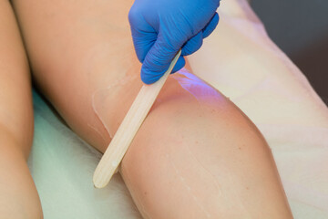 Laser hair removal procedure in a beauty salon. Removal of unwanted leg hair. The master applies the gel.