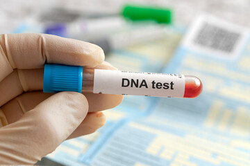 DNA test lettering on a white label. DNA blood test in the hand of a doctor or scientist in the...