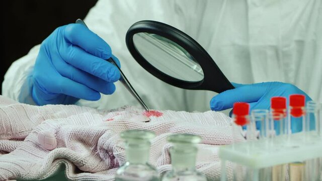 Forensics examines evidence - traces of blood on clothes