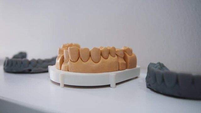 Orthodontic modern dental models produced in advanced 3D printer inside stomatology laboratory. Oral arts. Healthcare. Advancement in dental technologies.