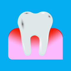 Realistic icon with tooth in the gum for marketing design. Tooth in the gum. Realistic vector illustration. Hygiene product. Procedure mask.