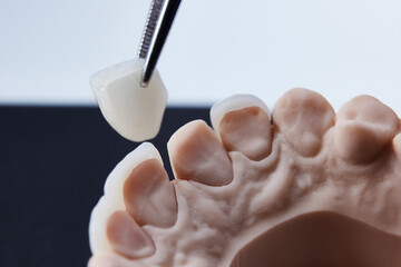 Fototapeta na wymiar Ceramic dental veneers. Close-up view of dental layout of lower row of teeth prothesis on artificial jaw, medical concept. Shallow dof.