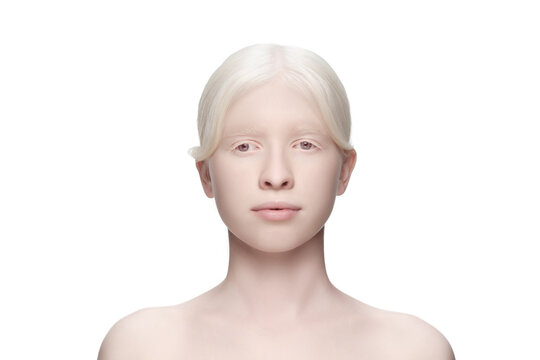 Purity. Portrait of beautiful albino woman isolated on white studio background. Beauty, fashion, skincare, cosmetics concept. Copyspace. Well-kept skin, fresh look. Inclusion and diversity.