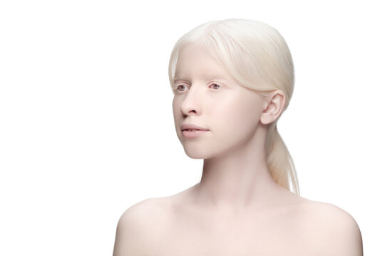 Purity. Portrait of beautiful albino woman isolated on white studio background. Beauty, fashion, skincare, cosmetics concept. Copyspace. Well-kept skin, fresh look. Inclusion and diversity.