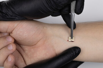The cosmetic surgeon made a small incision to insert the chip into the patient's arm....