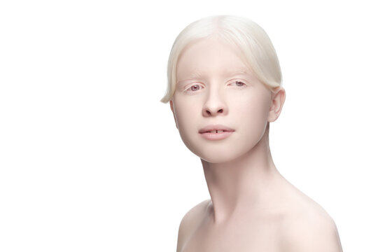 Perfect. Portrait of beautiful albino woman isolated on white studio background. Beauty, fashion, skincare, cosmetics concept. Copyspace. Well-kept skin, fresh look. Inclusion and diversity.
