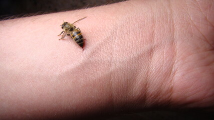 Obraz premium bee : apis mellifera treatment by honey bee sting closeup honey bee stinging a hand close up bee worker insects, insect, animal, wildlife, wild nature, forest, woods, garden beauty of pollination 