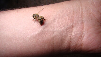 bee : apis mellifera treatment by honey bee sting closeup honey bee stinging a hand close up bee...