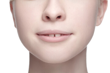 Smile. Close up portrait of beautiful albino woman isolated on white studio background. Beauty, fashion, skincare, cosmetics concept. Copyspace. Well-kept skin, fresh look. Inclusion and diversity.