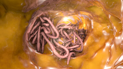 Parasitic worms in the lumen of intestine