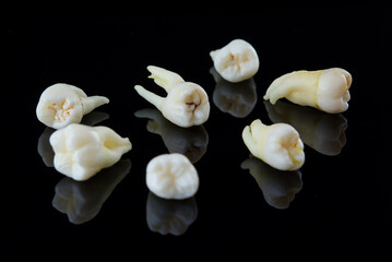 Torn human teeth on a black background. Close-up photo of spoiled molars and premolars. Selective...