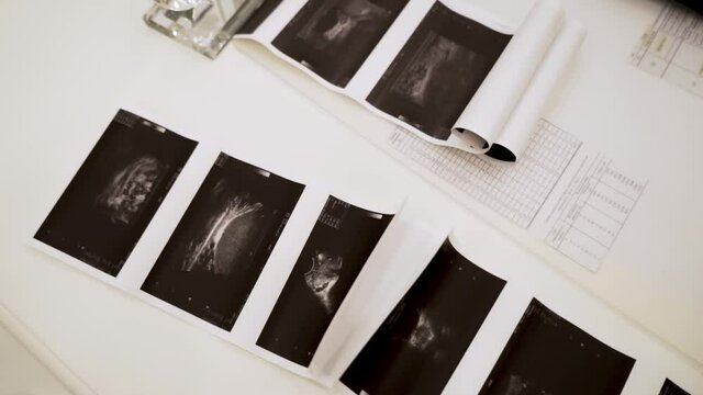 Close up of ultrasound images lying on white table background. Action. Concept of health care and medicine, black and white images of medical diagnostics.