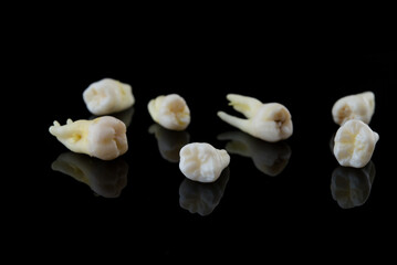 Torn human teeth on a black background. Close-up photo of spoiled molars and premolars. Selective focus.