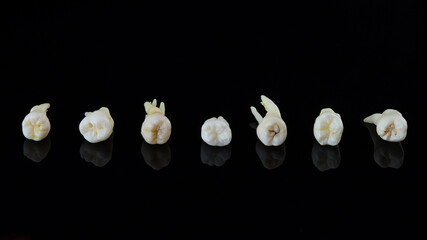Torn human teeth stacked in a row on a black background. Close-up photo of spoiled molars and premolars.