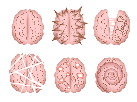 Mental Disorder Vector Illustrations Isolated. Abstract Depictions Of Human Brain Altered By Various Mental Illnesses, Psychiatric Disorders, Neurological Disorders Or Diseases.