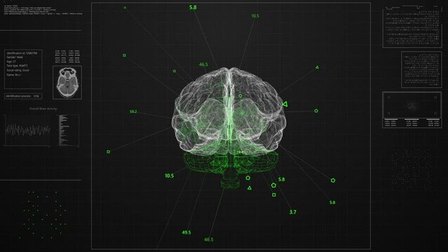 Brain scanning process. Wireframe style animation
