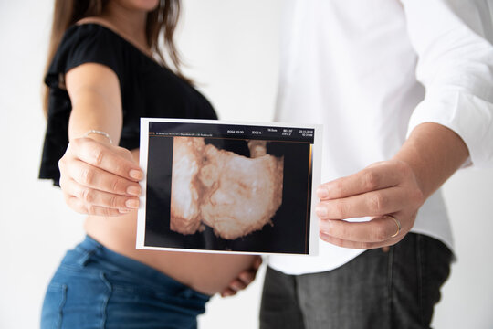 couple showing ultrasound of their baby
